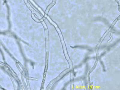 organism under microscope